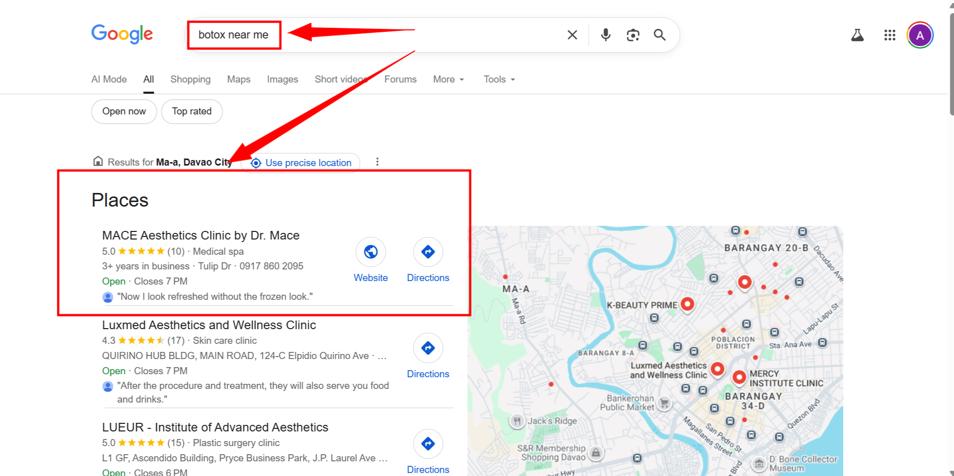 MACE ranking #1 for botox near me