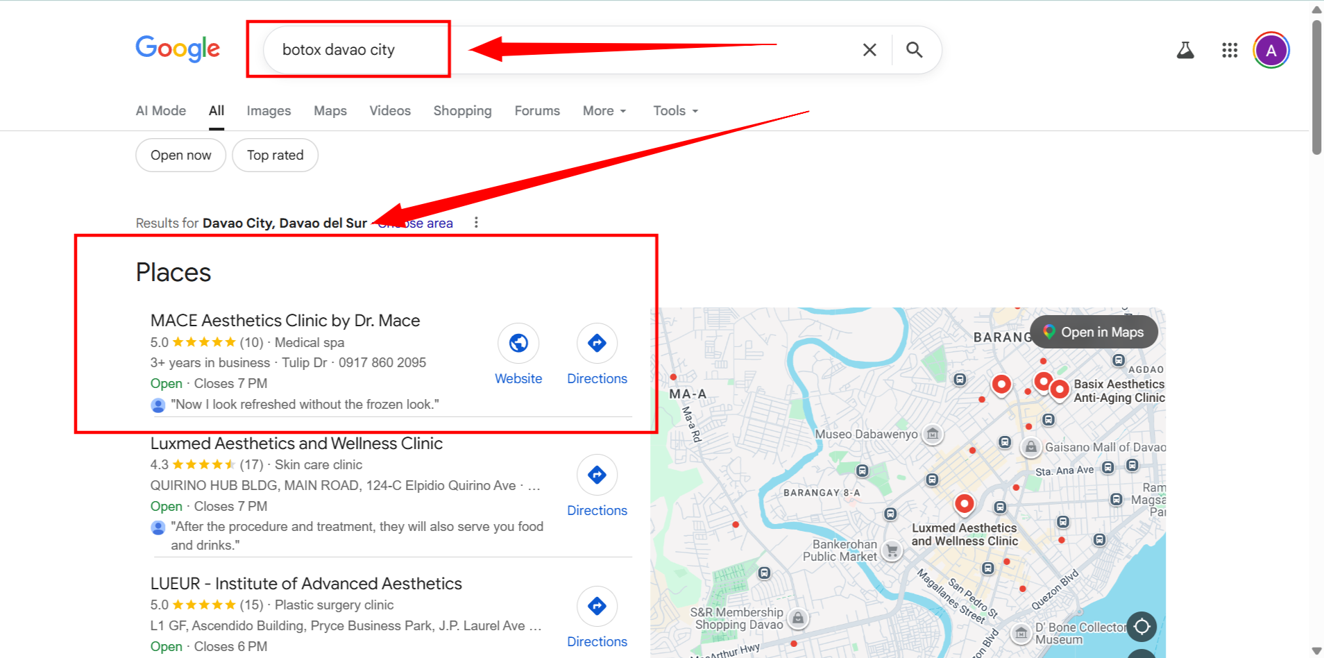 MACE ranking #1 for botox davao city